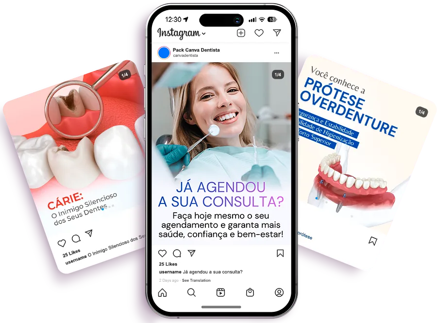 Exemplos de posts do Ultra Pack Canva Dentista